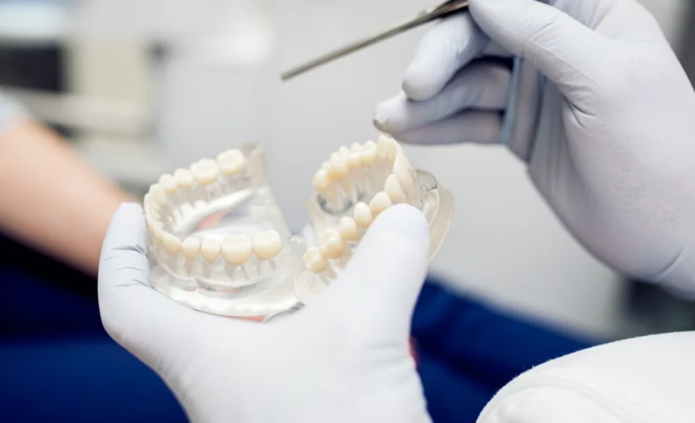 Dental Bonding