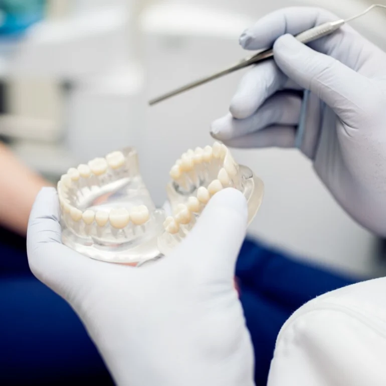 Dental Bonding
